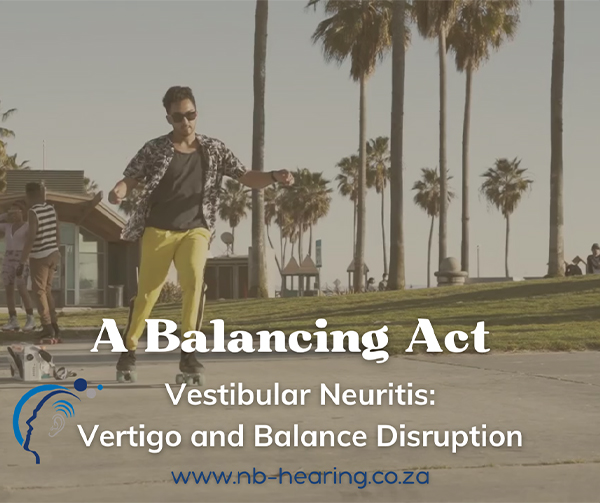 Vestibular-Neuritis_10-April-2024
